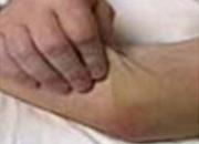 Elbow and Wrist Injuries - Self-Volume #3 Elbow and Wrist Injuries - Self-Volume #3